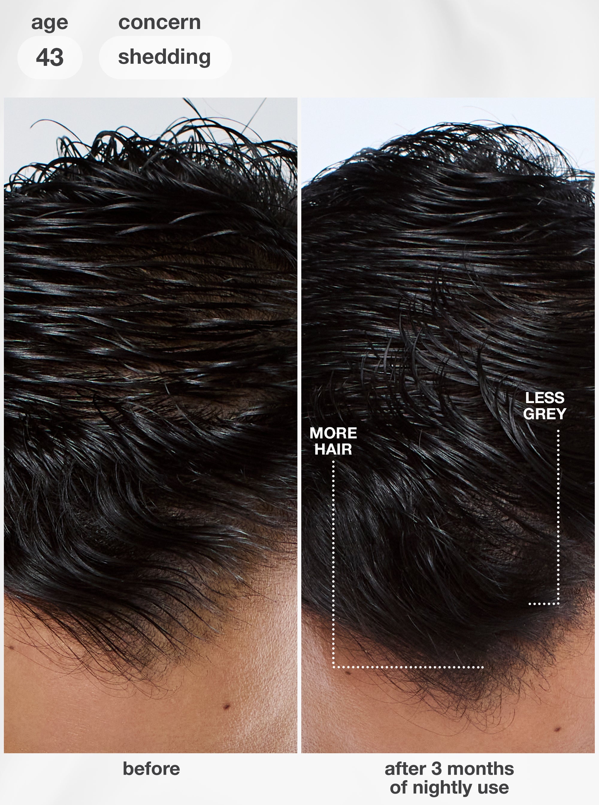 FutureIQ™ biomimetic hair longevity serum