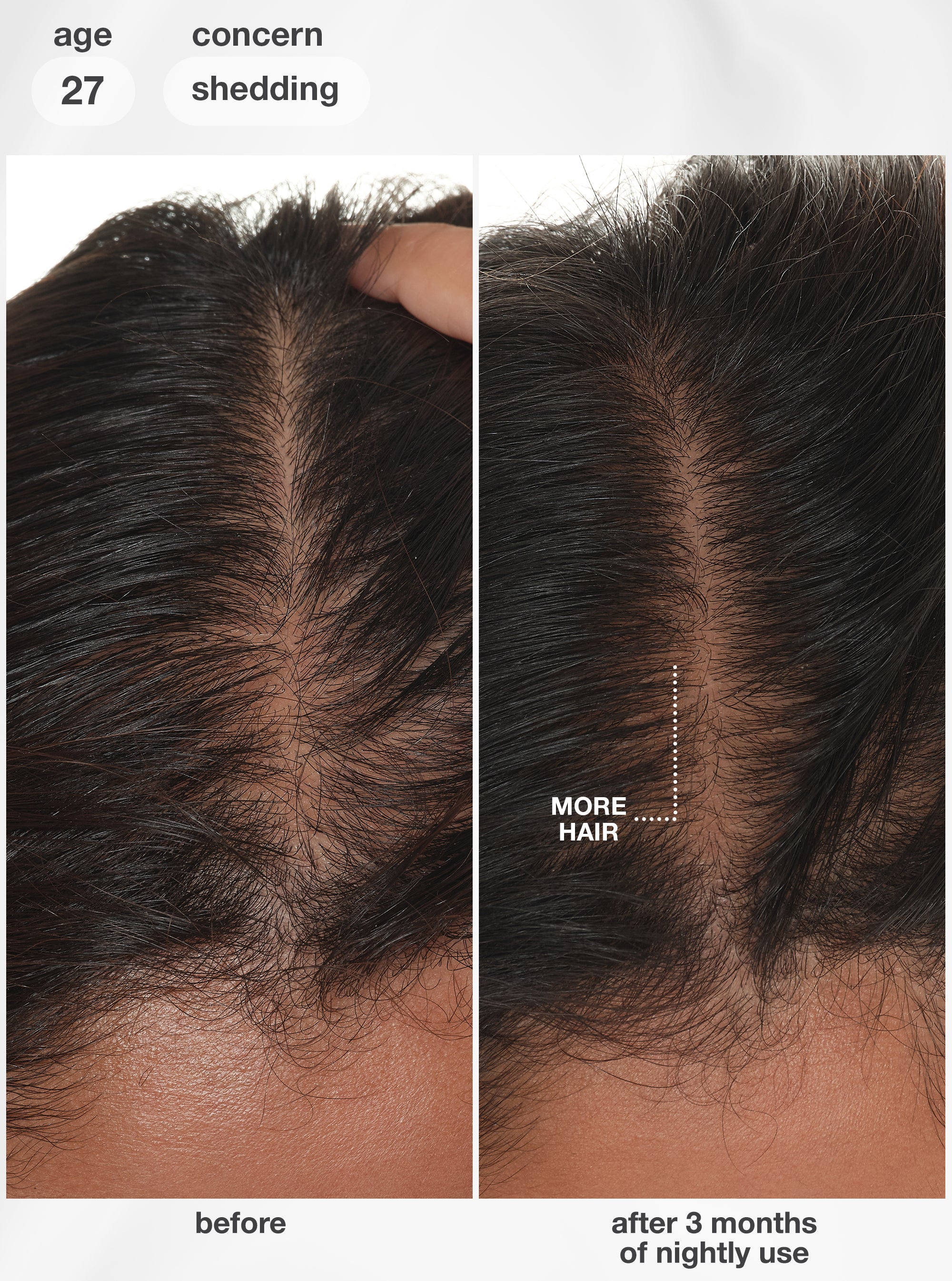 FutureIQ™ biomimetic hair longevity serum