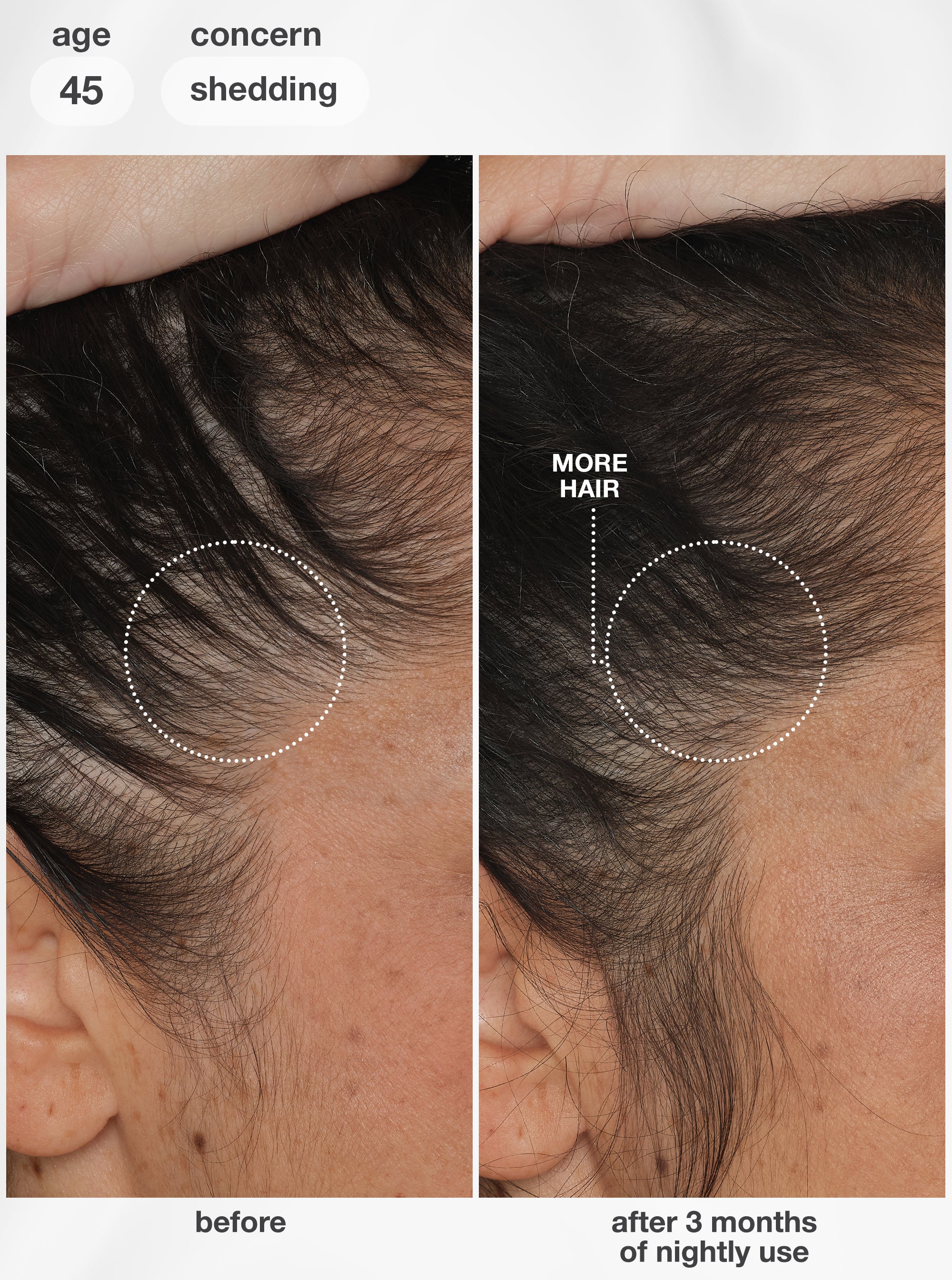 FutureIQ™ biomimetic hair longevity serum